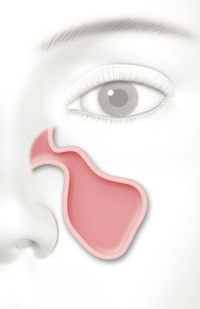 Woman-Sinus.jpg
