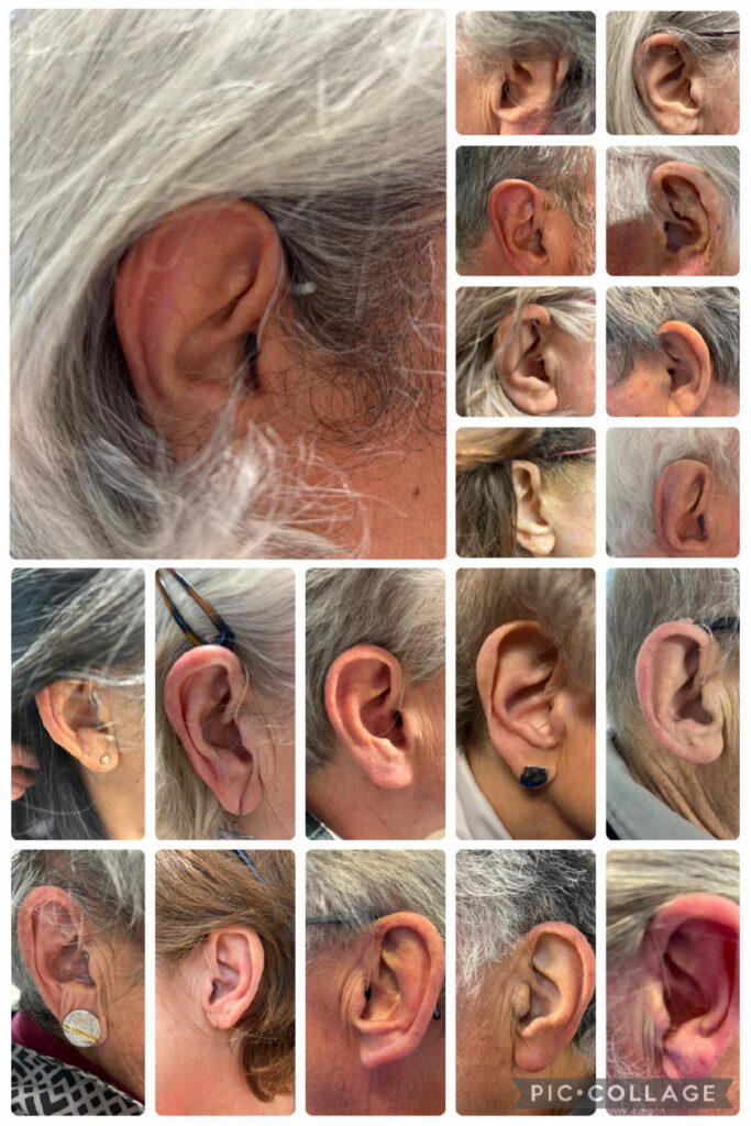 Ear 2