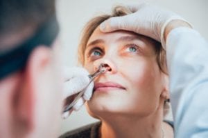 an ear, nose, and throat specialist examining his patient's nose for blockages