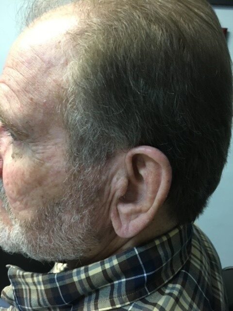 RIC in Ear