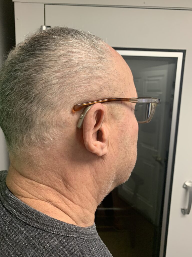 IMG 3495