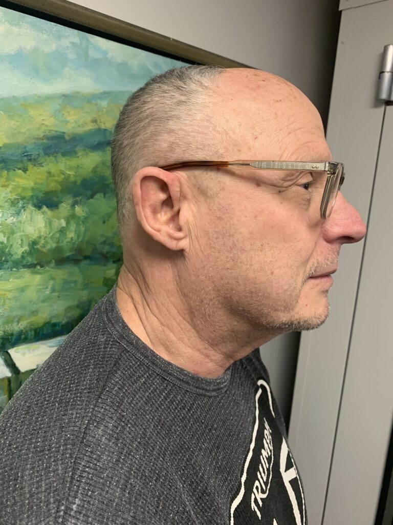 IMG 3494
