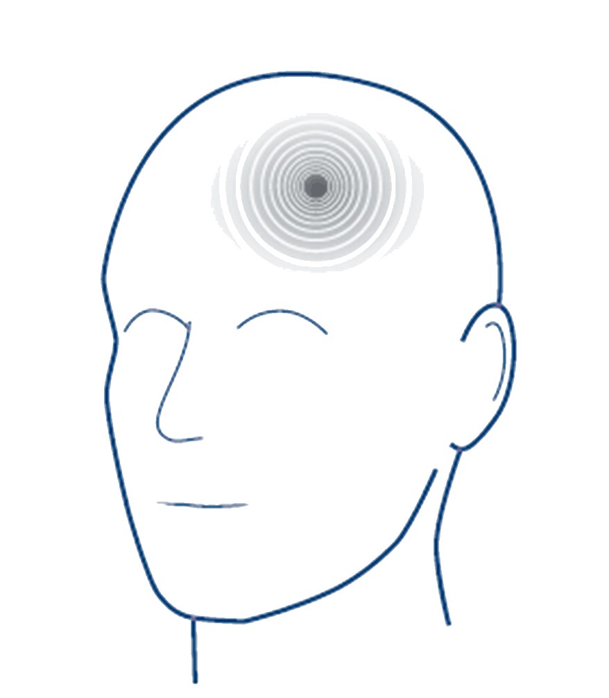 Tinnitus ringing in the brain 89dle6