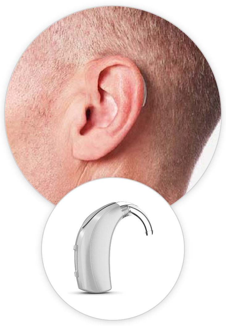 behind the ear hearing aid closeup on ear