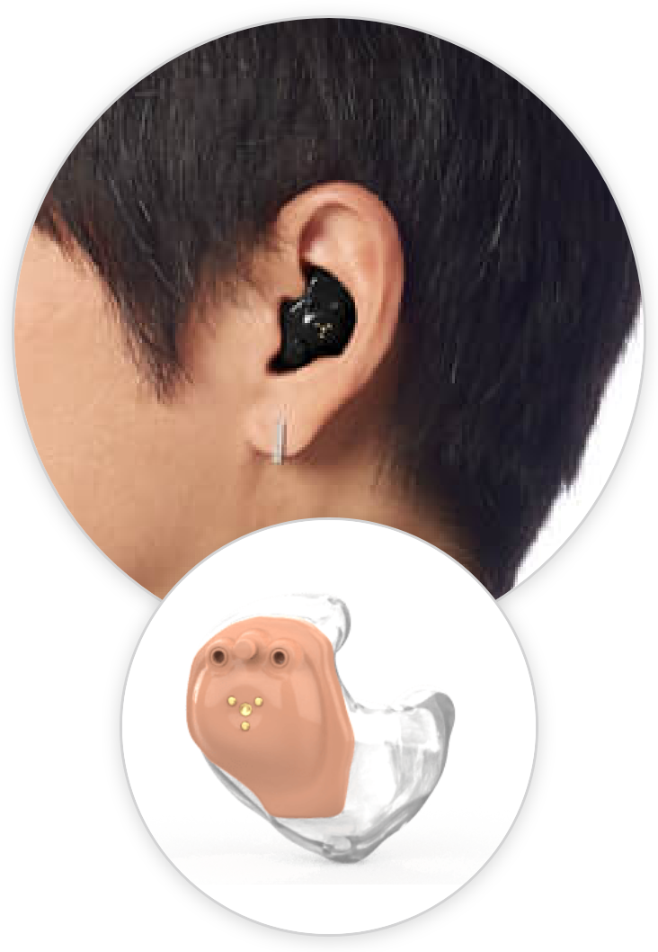 In The Ear (ITE)