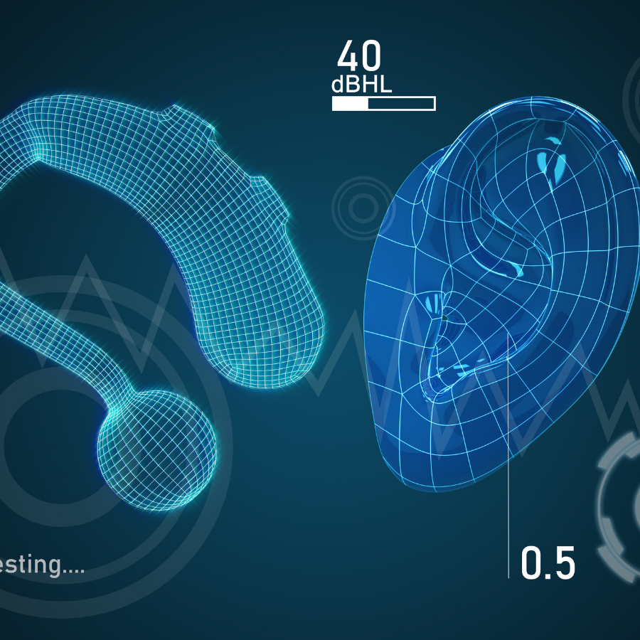 Sensorineural Hearing Loss