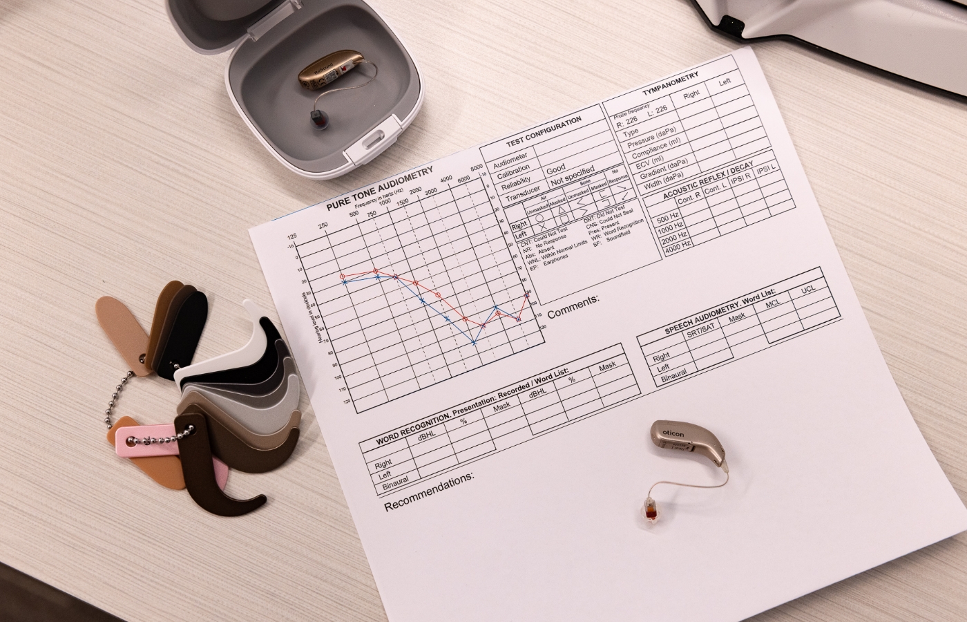 image audiogram results and hearing aid