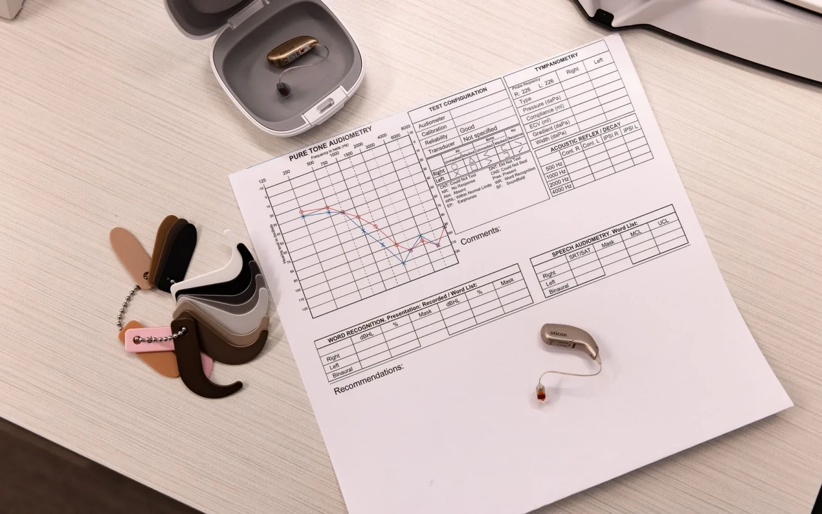 Audiogram test results sheet with hearing aid devices and color ear mold samples on a desk.