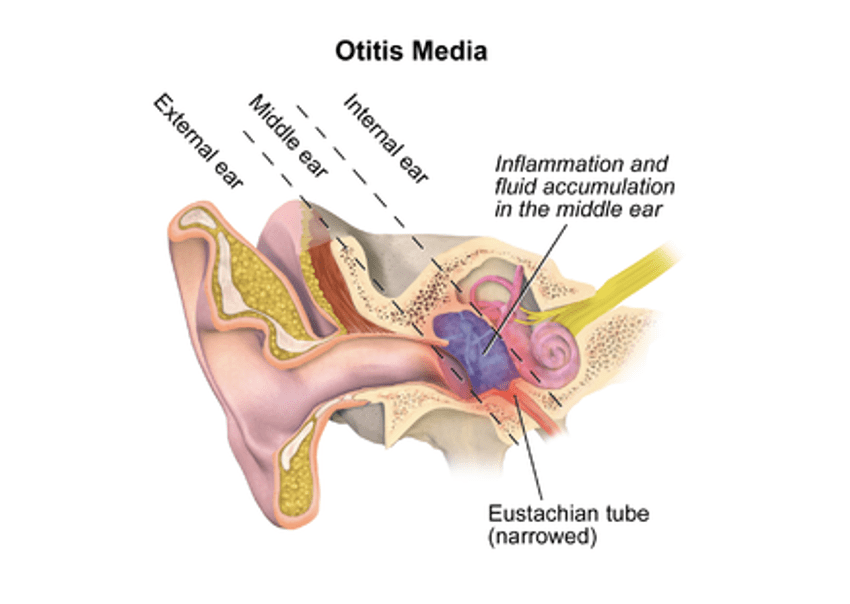 Otis Media