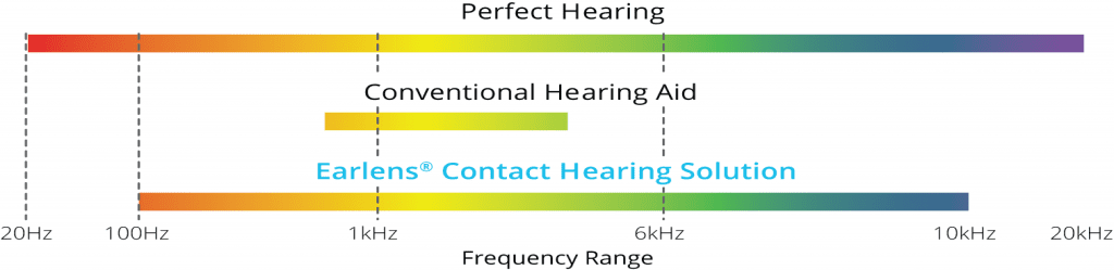 frequency range complete 1