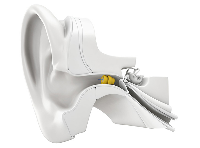 audiologist looking into patient's ear canal
