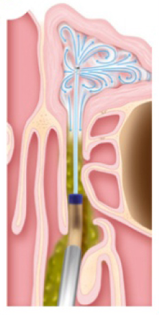 3 balloon.png 3 balloon.png