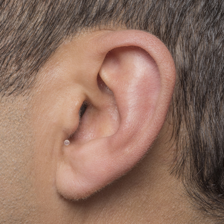 newPhonak_Invisible_In_Canal_Male_Side_Crop.jpg IIC