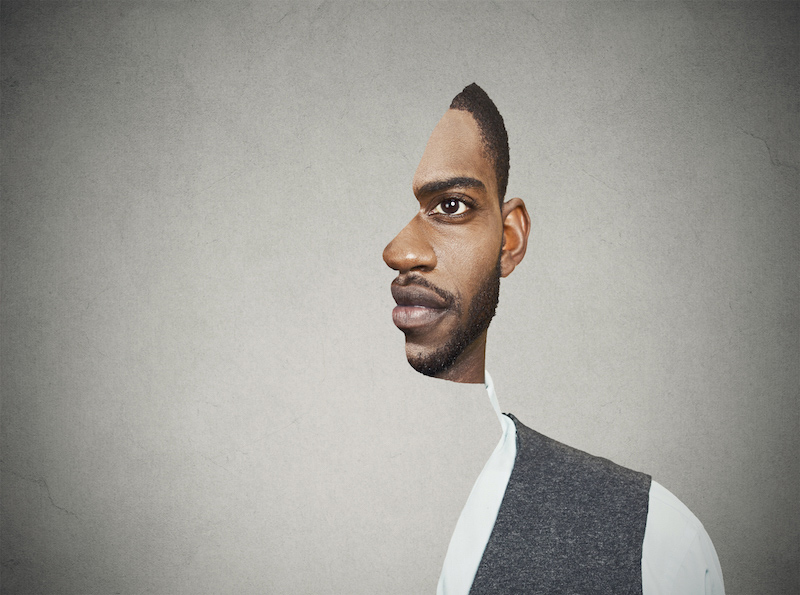 Man suffering from single-sided hearing loss is only experiencing one half of the world because he can't hear the other.