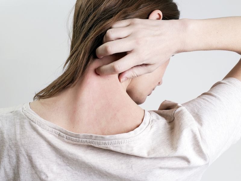 Woman scratching at psoriasis not realizing it can lead to hearing loss.