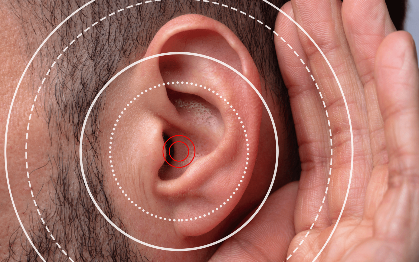 Why You Should Never Pretend to Hear With Hearing Loss