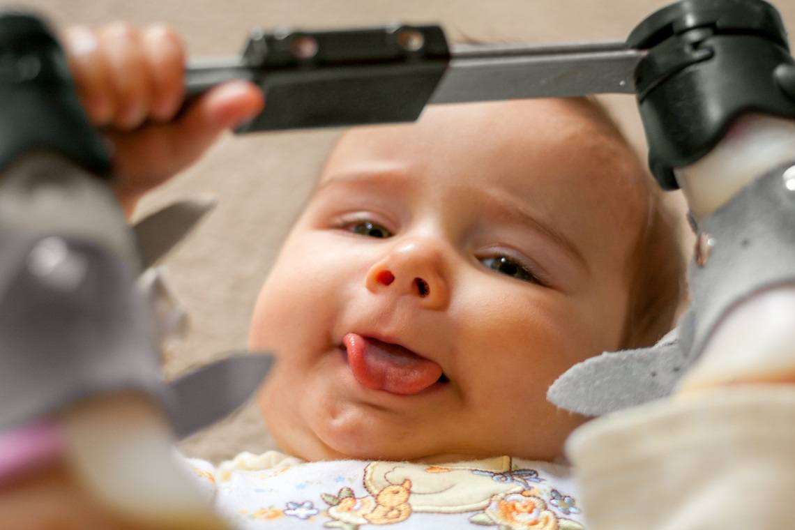 tongue tie symptoms and treatment options