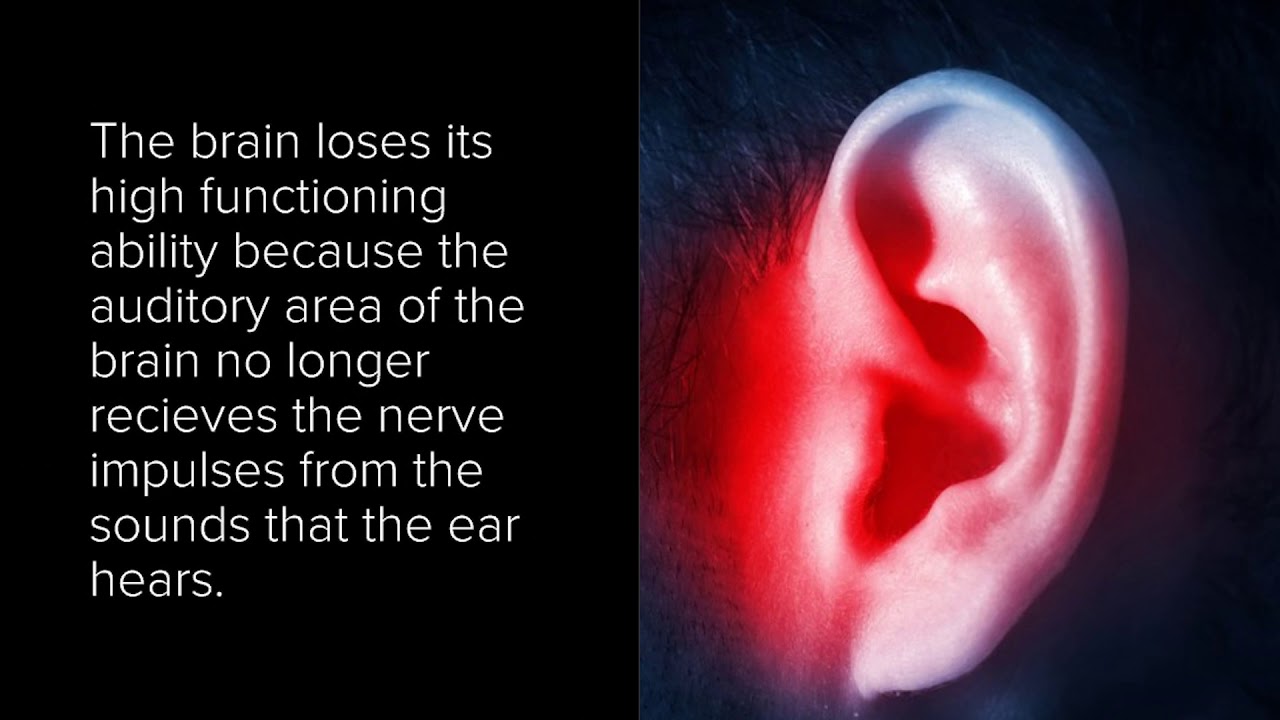 Hearing Loss and Dementia.jpg